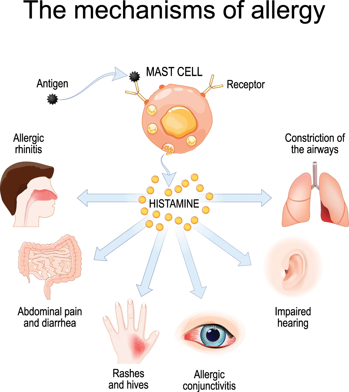 The mechanisms of allergy